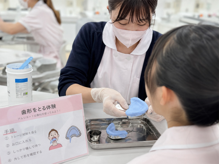 歯型の採得